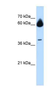 Western Blot: MMP23B Antibody [NBP1-59459] - Jurkat cell lysate, concentration 0.2-1 ug/ml.