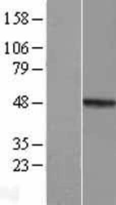 Western Blot: MMP23B Overexpression Lysate (Adult Normal) [NBL1-13157] Left-Empty vector transfected control cell lysate (HEK293 cell lysate); Right -Over-expression Lysate for MMP23B.