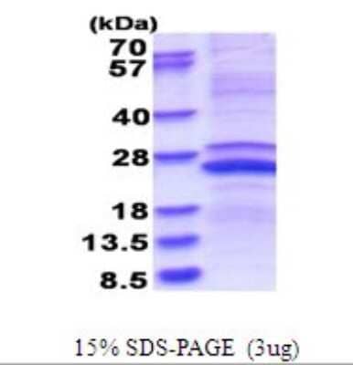 SDS-Page: Recombinant Human MMP23B Protein [NBP2-51673] - 15% SDS Page (3 ug)