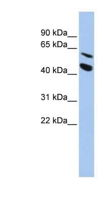 Western Blot: MMP24 Antibody [NBP1-59458] - HepG2 cell lysate, concentration 0.2-1 ug/ml.