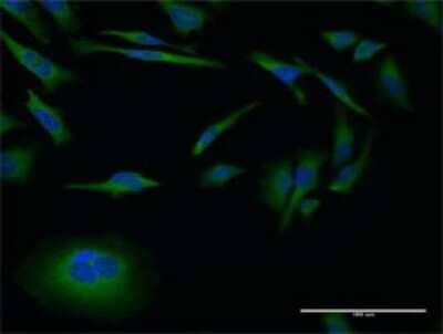 Immunocytochemistry/Immunofluorescence: MMP26 Antibody (3B9) [H00056547-M02] - Analysis of monoclonal antibody to MMP26 on HeLa cell . Antibody concentration 10 ug/ml.