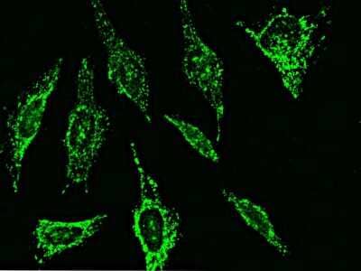 Immunocytochemistry/Immunofluorescence: MMP26 Antibody [NBP3-00124] - Immunofluorescence staining of MMP26 in Hela cells. Cells were fixed with 4% PFA, permeabilzed with 0.3% Triton X-100 in PBS, blocked with 10% serum, and incubated with rabbit anti-Human MMP26 polyclonal antibody (dilution ratio: 1:1000) at 4C overnight. Then cells were stained with the Alexa Fluor(R)488-conjugated Goat Anti-rabbit IgG Secondary antibody (green)Positive staining was localized to cytoplasm.