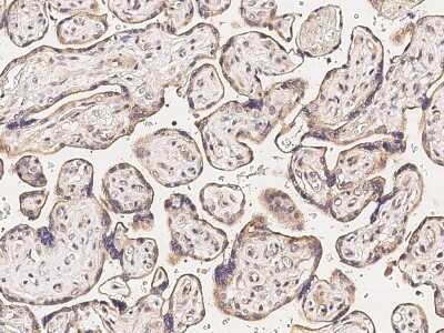 Immunohistochemistry-Paraffin: MMP26 Antibody [NBP3-00124] - Staining of human MMP26 in human placenta with rabbit polyclonal antibody at 1:500 dilution.