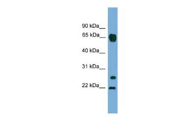 Western Blot: MMP26 Antibody [NBP2-86707] - WB Suggested Anti-MMP26 Antibody Titration: 0.2-1 ug/ml. ELISA Titer: 1:1562500. Positive Control: A549 cell lysateMMP26 is supported by BioGPS gene expression data to be expressed in A549