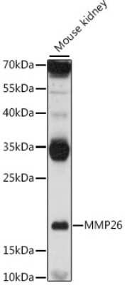 Western Blot: MMP26 Antibody [NBP3-05179] - Analysis of extracts of mouse kidney, using MMP26 antibody at 1:1000 dilution. Secondary antibody: HRP Goat Anti-Rabbit IgG (H+L) at 1:10000 dilution. Lysates/proteins: 25ug per lane. Blocking buffer: 3% nonfat dry milk in TBST. Detection: ECL Basic Kit .