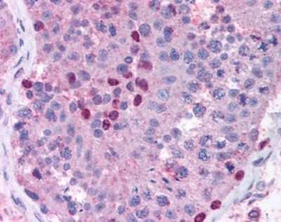 Immunohistochemistry-Paraffin: MMP28 Antibody [NBP1-02514] - Staining of human testis. Immunohistochemistry of formalin-fixed, paraffin-embedded tissue after heat-induced antigen retrieval. Antibody concentration 10 ug/ml.