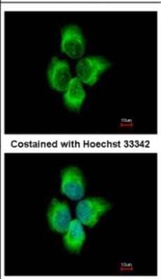 Immunocytochemistry/Immunofluorescence: MMP8 Antibody [NBP2-17316] - Immunofluorescence analysis of methanol-fixed A431, using antibody at 1:500 dilution.