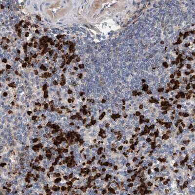 Immunohistochemistry-Paraffin: MMP8 Antibody [NBP1-85576] - Staining of human spleen shows strong cytoplasmic positivity in cells of red pulp.