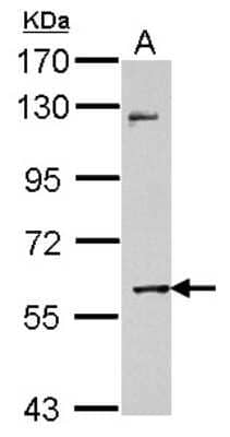 Western Blot: MMP8 Antibody [NBP2-17316] - Sample (30 ug of whole cell lysate) A: HCT116 7. 5% SDS PAGE gel, diluted at 1:10000.