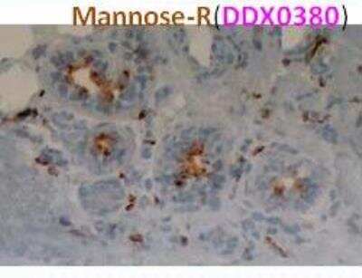 Immunohistochemistry-Paraffin: MMR/CD206/Mannose Receptor Antibody (122D2.08) [DDX0380P-100] - Expression of C-type lectin receptors on human skin