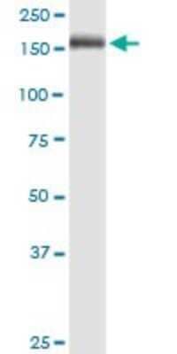 Western Blot: MMR/CD206/Mannose Receptor Antibody (5C11) [H00004360-M02] - MRC1 monoclonal antibody (M02), clone 5C11. Analysis of MRC1 expression in human pancreas.