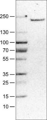 <b>Orthogonal Strategies Validation. </b>Western Blot: MMR/CD206/Mannose Receptor Antibody (CL0387) [NBP2-52927] - Lane 1: Marker [kDa], Lane 2: Human liver tissue lysate