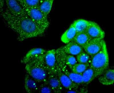 Immunocytochemistry/Immunofluorescence: MMR/CD206/Mannose Receptor Antibody (JF0953) [NBP2-66956] - Staining Mannose Receptor in MCF-7 cells (green). The nuclear counter stain is DAPI (blue). Cells were fixed in paraformaldehyde, permeabilised with 0.25% Triton X100/PBS.