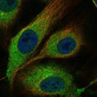 <b>Orthogonal Strategies Validation. </b>Immunocytochemistry/Immunofluorescence: MMRN1 Antibody [NBP1-84014] - Staining of human cell line HUVEC TERT2 shows localization to endoplasmic reticulum. Antibody staining is shown in green.
