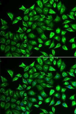 Immunocytochemistry/ Immunofluorescence MMRN1 Antibody - Azide and BSA Free