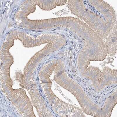 Immunohistochemistry-Paraffin: MMRN1 Antibody [NBP1-84014] - Staining of human gallbladder shows high expression.