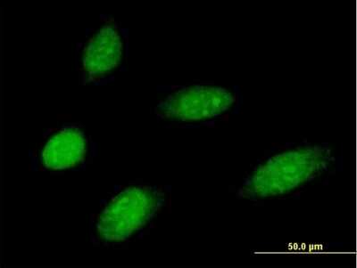 Immunocytochemistry/Immunofluorescence: MMS19 like protein Antibody [H00064210-B01P] - Analysis of purified antibody to MMS19 on HeLa cell. (antibody concentration 10 ug/ml)