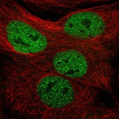 Immunocytochemistry/ Immunofluorescence MMS19 like protein Antibody