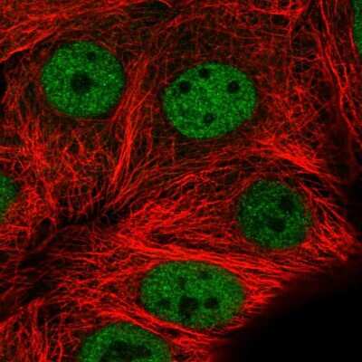 Immunocytochemistry/Immunofluorescence: MMS19 like protein Antibody [NBP2-55388] - Staining of human cell line MCF7 shows localization to nucleoplasm.