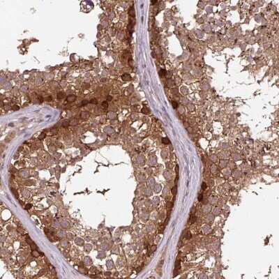 Immunohistochemistry MMS19 like protein Antibody