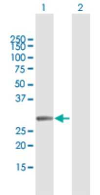 Western Blot: MMS19 like protein Antibody [H00064210-B02P] - Analysis of MMS19 expression in transfected 293T cell line by MMS19 polyclonal antibody.  Lane 1: MMS19 transfected lysate(31.90 KDa). Lane 2: Non-transfected lysate.