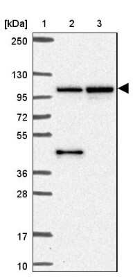 Western Blot MMS19 like protein Antibody