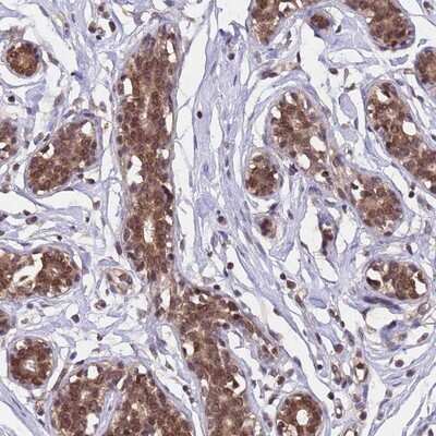Immunohistochemistry-Paraffin: MMTAG2 Antibody [NBP1-92128] - Staining of human breast shows moderate cytoplasmic and nuclear positivity in glandular cell.