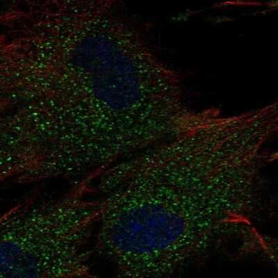 Immunocytochemistry/ Immunofluorescence MNAB Antibody - BSA Free