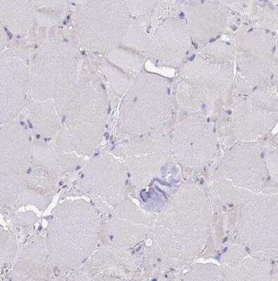 Immunohistochemistry-Paraffin MNAB Antibody - BSA Free