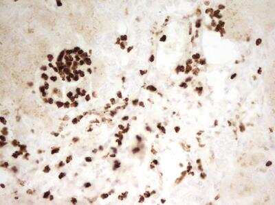 Immunohistochemistry-Paraffin: MNDA Antibody (OTI4H6) - Azide and BSA Free [NBP2-72741] - Human liver tissue within the normal limits using anti-MNDA mouse monoclonal antibody. (Heat-induced epitope retrieval by 1mM EDTA in 10mM Tris, pH8.5, 120 degrees C for 3min