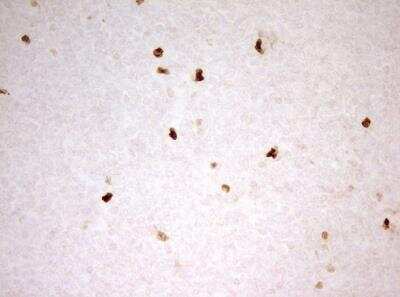 Immunohistochemistry-Paraffin: MNDA Antibody (OTI4H6) - Azide and BSA Free [NBP2-72741] - Human tonsil within the normal limits using anti-MNDA mouse monoclonal antibody. (Heat-induced epitope retrieval by 1mM EDTA in 10mM Tris, pH8.5, 120 degrees C or 3min.