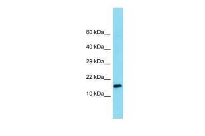 Western Blot: MNF1 Antibody [NBP2-83216] - Host: Rabbit. Target Name: MNF1. Sample Type: 293T Whole Cell lysates. Antibody Dilution: 1.0ug/ml
