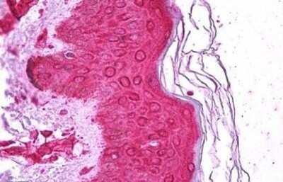 Immunohistochemistry-Paraffin: MNK1 Antibody (24C2) [NBP2-11526] - Staining of human skin tissue after heat-induced antigen retrieval. Antibody dilution 1:400.