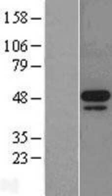 Western Blot MNK2 Overexpression Lysate