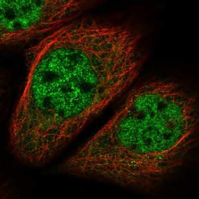Immunocytochemistry/ Immunofluorescence MNS1 Antibody - BSA Free