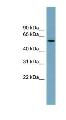 Western Blot: MNS1 Antibody [NBP1-53041] - Hela cell lysate, concentration 0.2-1 ug/ml.