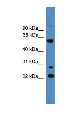 Western Blot: MNS1 Antibody [NBP1-69201] - 721_B cell lysate, concentration 0.2-1 ug/ml.