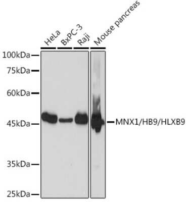 Western Blot: MNX1/HLXB9 Antibody (9P1B7) [NBP3-15861] - Western blot analysis of extracts of various cell lines, using MNX1/MNX1/HLXB9 Rabbit mAb (NBP3-15861) at 1:1000 dilution. Secondary antibody: HRP Goat Anti-Rabbit IgG (H+L) at 1:10000 dilution. Lysates/proteins: 25ug per lane. Blocking buffer: 3% nonfat dry milk in TBST. Detection: ECL Basic Kit. Exposure time: 1s.