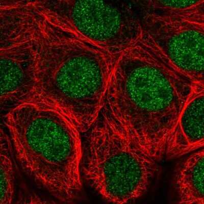 Immunocytochemistry/Immunofluorescence: MNX1/HLXB9 Antibody [NBP2-57703] - Staining of human cell line MCF7 shows localization to nucleus. Antibody staining is shown in green. 