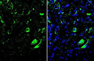 Immunohistochemistry-Frozen: MNX1/HLXB9 Antibody [NBP3-13412] - MNX1/HLXB9 antibody detects MNX1/HLXB9 protein by immunohistochemical analysis. Sample: Frozen-sectioned mouse spinal cord. Green: MNX1/HLXB9 stained by MNX1/HLXB9 antibody (NBP3-13412) diluted at 1:300. Blue: Hoechst 33342 staining.