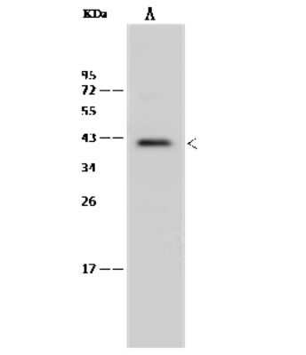 Western Blot: MNX1/HLXB9 Antibody [NBP2-99434] - Anti-MNX1/HLXB9 rabbit polyclonal antibody at 1:500 dilution. Lane A: Mouse spleen tissue lysate Lysates/proteins at 30 ug per lane. Secondary Goat Anti-Rabbit IgG (H+L)/HRP at 1/10000 dilution. Developed using the ECL technique. Performed under reducing conditions. Predicted band size: 41 kDa. Observed band size: 41 kDa