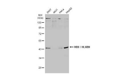 Western Blot: MNX1/HLXB9 Antibody [NBP3-13412] - Various whole cell extracts (30 ug) were separated by 10% SDS-PAGE, and the membrane was blotted with MNX1/HLXB9 antibody (NBP3-13412) diluted at 1:500. The HRP-conjugated anti-rabbit IgG antibody (NBP2-19301) was used to detect the primary antibody.