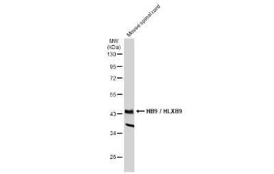 Western Blot: MNX1/HLXB9 Antibody [NBP3-13412] - Mouse tissue extract (50 ug) was separated by 10% SDS-PAGE, and the membrane was blotted with MNX1/HLXB9 antibody (NBP3-13412) diluted at 1:1000. The HRP-conjugated anti-rabbit IgG antibody (NBP2-19301) was used to detect the primary antibody.