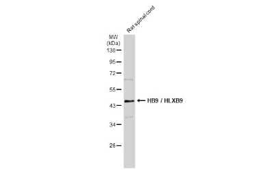 Western Blot: MNX1/HLXB9 Antibody [NBP3-13412] - Rat tissue extract (50 ug) was separated by 10% SDS-PAGE, and the membrane was blotted with MNX1/HLXB9 antibody (NBP3-13412) diluted at 1:1000. The HRP-conjugated anti-rabbit IgG antibody (NBP2-19301) was used to detect the primary antibody.