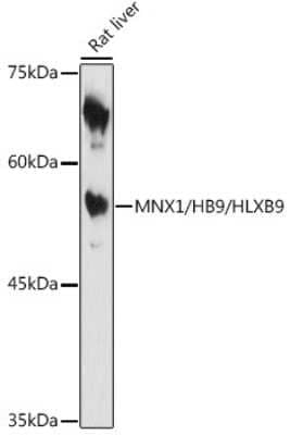 Western Blot: MNX1/HLXB9 Antibody [NBP3-16042] - Western blot analysis of extracts of Rat liver, using MNX1/HLXB9 antibody (NBP3-16042) at 1:1000 dilution. Secondary antibody: HRP Goat Anti-Rabbit IgG (H+L) at 1:10000 dilution. Lysates/proteins: 25ug per lane. Blocking buffer: 3% nonfat dry milk in TBST. Detection: ECL Enhanced Kit. Exposure time: 180s.