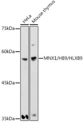 Western Blot: MNX1/HLXB9 Antibody [NBP3-16042] - Western blot analysis of extracts of various cell lines, using MNX1/HLXB9 antibody (NBP3-16042) at 1:1000 dilution. Secondary antibody: HRP Goat Anti-Rabbit IgG (H+L) at 1:10000 dilution. Lysates/proteins: 25ug per lane. Blocking buffer: 3% nonfat dry milk in TBST. Detection: ECL Basic Kit. Exposure time: 180s.