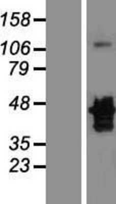 Western Blot: MNX1/HLXB9 Overexpression Lysate (Adult Normal) [NBL1-13167] Left-Empty vector transfected control cell lysate (HEK293 cell lysate); Right -Over-expression Lysate for MNX1/HLXB9.