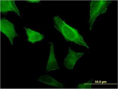 Immunocytochemistry/Immunofluorescence: MOB4A Antibody (2F8) [H00092597-M07] - Analysis of monoclonal antibody to MOBKL1A on HeLa cell. Antibody concentration 10 ug/ml