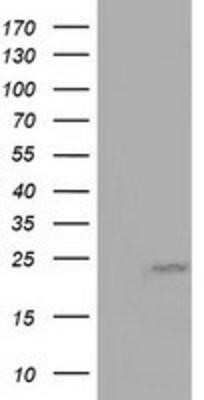 Western Blot: MOB4A Antibody (OTI3G9) - Azide and BSA Free [NBP2-72744] - HEK293T cells were transfected with the pCMV6-ENTRY control (Left lane) or pCMV6-ENTRY MOB4A (Right lane) cDNA for 48 hrs and lysed. Equivalent amounts of cell lysates (5 ug per lane) were separated by SDS-PAGE and immunoblotted with anti-MOB4A.