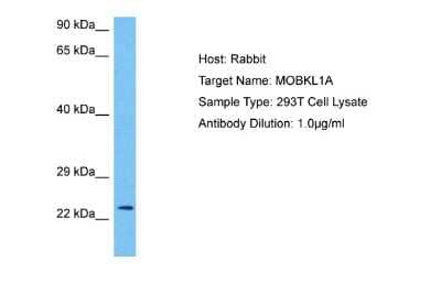 Western Blot: MOB4A Antibody [NBP2-86710] - Host: Rabbit. Target Name: MOBKL1A. Sample Tissue: Human 293T Whole Cell lysates. Antibody Dilution: 1ug/ml